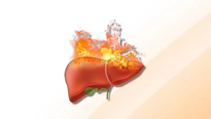 Các dấu hiệu và cách chữa bệnh nóng gan hiệu quả