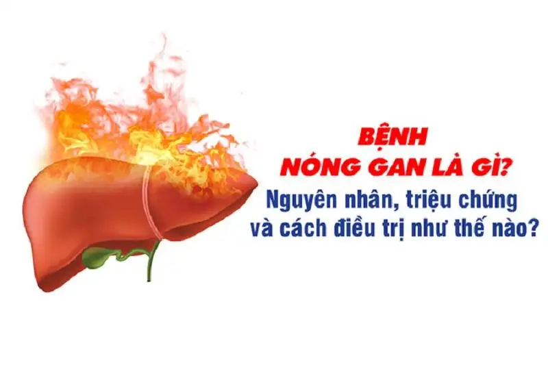 Chữa nóng gan mẩn ngứa nguyên nhân dấu hiệu và cách điều trị hiệu quả
